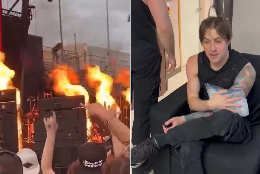 Terrifying Fire At Falling In Reverse Show: Two Band Members Injured